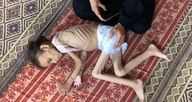 Gazze'de açlıkla mücadele: 9 yaşındaki Meryem 10 kiloya düştü