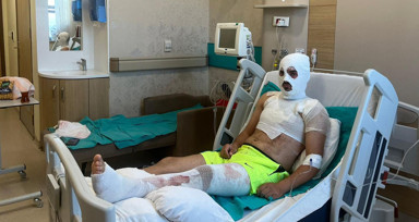 Bayburt’ta elektrik akımına kapılan 22 yaşındaki genç ölümden döndü, vücudunda 3'üncü derece yanıklar oluşan gencin ailesi isyan etti