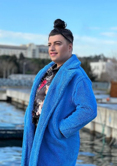 Fenomen isim Mükremin, yaptırdığı estetik operasyonla dillere düştü - Resim: 3