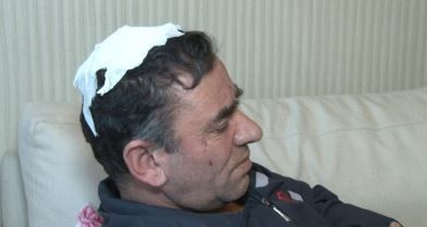 3 kardeşin miras davası kanlı bitti! Davalı yeğen, amcasının kafa derisini yüzdü - Resim: 2