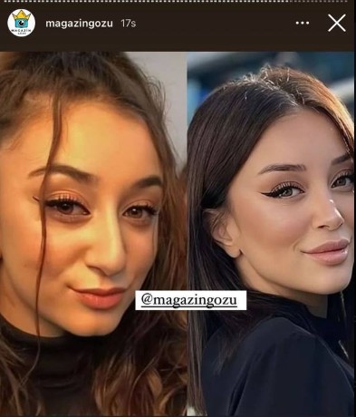 Dilan Polat'ın eltisi Hazal'ın estetiksiz hali ortaya çıktı! Görenler şaşkınlıklarını gizleyemedi - Resim: 7