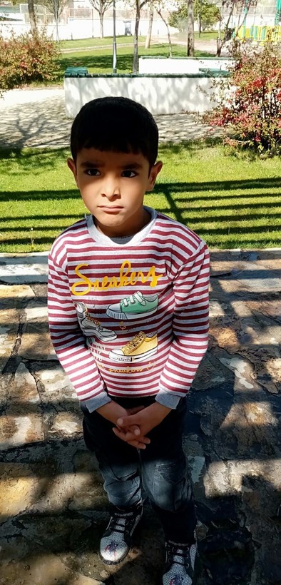 Gaziantep'te sokak köpeğinin saldırdığı 6 yaşındaki Nihatcan'ın saç derisi koptu! - Resim: 8