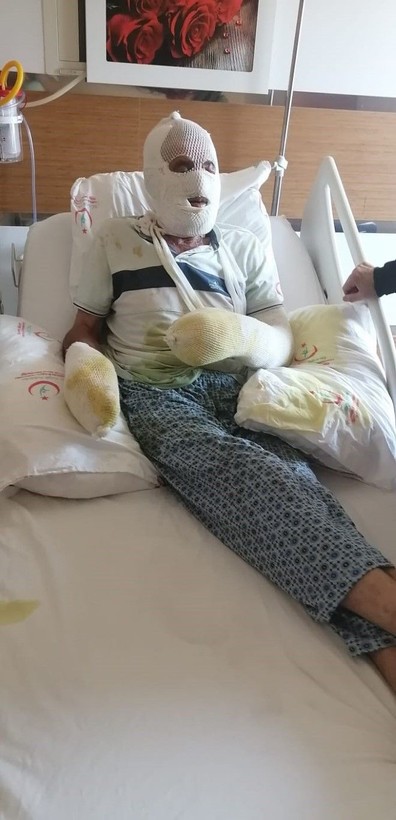 Çanakkale'de alevlerin arasında kaldı ölümden döndü! Dehşet anları anlattı: Yukarıdan ateş yağıyordu - Resim: 27