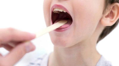 Strep A Türkiye'de 3 ili alarma geçirdi