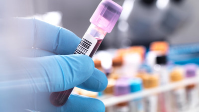 MPV nedir, değeri kaç olmalı?