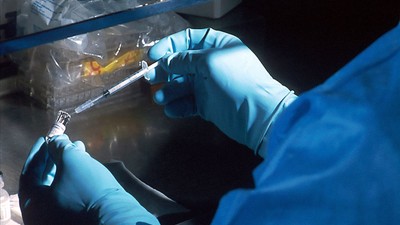 İddialar doğruysa ortalık karışır! Listede Türkiye de var: Prof. Dr. Alper Şener: Sessiz bir 'HIV pandemisi' var