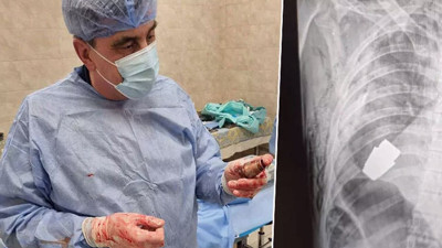 Ukrayna-Rusya savaşında bir tuhaf olay! Karnına el bombası saplanan asker ameliyat edildi