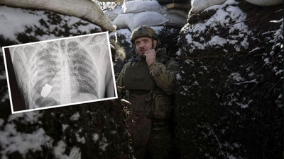 Rusya-Ukrayna savaşı 11. ayında! Ukraynalı askerin vücudunda patlamaya hazır bomba bulundu