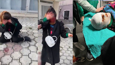 Sakarya'da gözü dönen adam barışmak istemeyen eşine kabusu yaşattı! Talihsiz kadın kanlar içinde kaldı! VİDEO İZLE