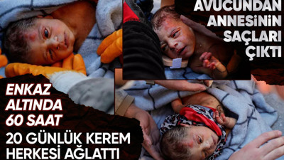 Bu yara nasıl kapanacak? 20 günlük minik Kerem enkaz altından 60 saat sonra kurtarıldı! Avucunda annesinin saçı kaldı...