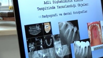 Prof. Dr. Mehmet Ali Kılıçarslan deprem kayıplarında hızlı ve güvenilir tespitin diş ile mümkün olduğunu söyledi