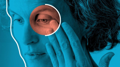 Gözlerdeki rahatsızlıklar pek çok ciddi hastalığın belirtisi olabilir