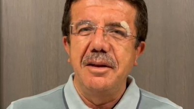 Kazada yaralanan eski Ekonomi Bakanı Nihat Zeybekci'nin sağlık durumu hakkında yeni gelişme