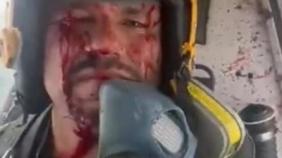 Devasa kuşun kokpite saplandığı o anlar sosyal medyada viral oldu! Soğukkanlı pilot uçağı uçurmaya devam etti