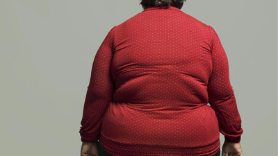 Bilim insanları açıkladı: Obeziteli bireylerin beyin şekli farklı