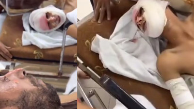 Gazze'de boğazları düğümleyen anlar! Babasıyla birlikte yaralanan çocuğun hastanedeki diyaloğu yürekleri dağladı