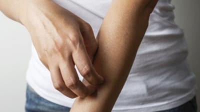 Uzmanlar uyarıyor! Uyuz vakasında artış meydana geldi... 6 soruda uyuz vakasının detayları