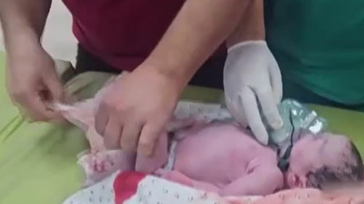 Çocuk, yaşlı, kadın fark etmeksizin vuran İsrail hamile bir kadını öldürdü! Doktorlar karnındaki bebeği kurtardı