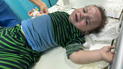 Gazze'deki kanser hastaları ve durumu acil olan yaralılar Türkiye'ye getirilecek! Mısır ile kritik görüşme