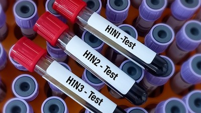 İngiltere'de H1N2 grip türü ilk kez insanda görüldü