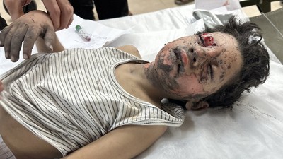 İsrail-Filistin savaşı sürüyor! Yaralanan çocuklar Aksa Şehitleri Hastanesi'ne getirildi
