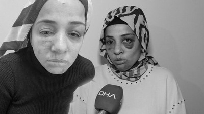 Bağcılar'da tüyler ürperten kadına şiddet! Eski kocasının ailesi sokak ortasında dövdü! Tanınmayacak geldi