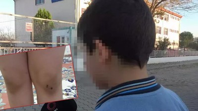 Denizli'de 11 yaşındaki çocuğa 7 akranından eğitim hayatını bitiren zorbalık