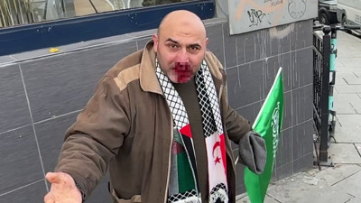 "Siz Arap sevicisiniz" diyerek Filistin'e destek yürüyüşüne katılan kişiye yumruk attı!