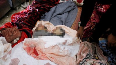 İsrail'in abluka altına aldığı Gazze'deki Nasr Hastanesinin elektriği 48 saat içerisinde kesilecek