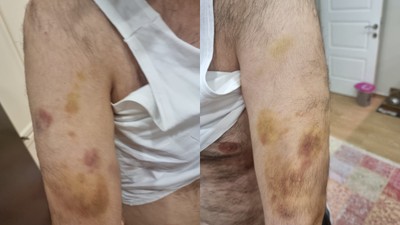 Spor okulu öğretmeni otizmli öğrenciyi darp edip boğazını sıktı