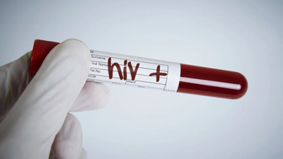 Gizli pandemi: AIDS! Türkiye'de HIV artışa geçti