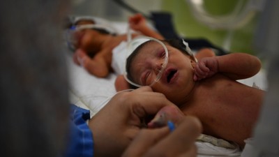 Gazze'de yaşanan insanlık dramını gösteren tablo: Bir kuvözde 2 bebek