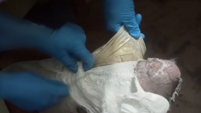 Muş'ta yolcunun ayağına sarılı alçıdan eroin çıktı