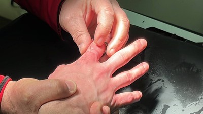 Bolu'da parmağına yüzük sıkışan vatandaşı itfaiye kurtardı