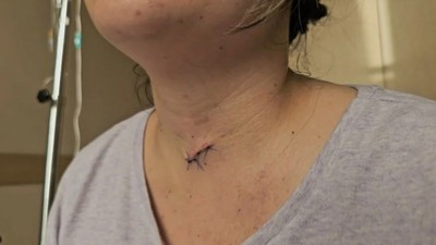 Ölmesi için başında bekledi! 22 yerinden bıçaklanan Dilem Gül Karlı yaşadığı dehşeti anlattı