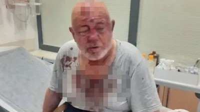 Konya'da 84 yaşındaki vakıf başkanına sopalı dayak! Yaşlı adam kanlar içinde kaldı