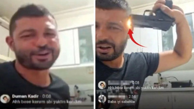 Kendisini yanlışlıkla başından vuran adam hayatını kaybetti