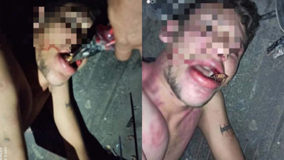 Antalya'da kan donduran olay! Maaşını istedi diye dişlerini kerpetenle söküp böcek yedirdiler