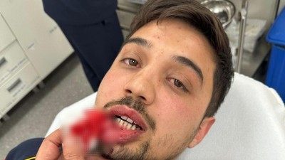 Tekstilci iş insanı ile oğlundan hasta taşıyan ambulans şoförüne saldırı