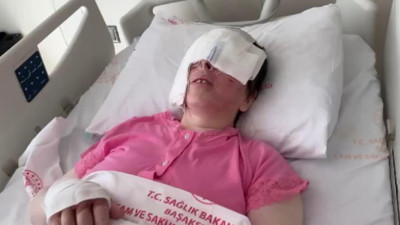 Yüzüne kezzap atıldı iki gözünü de kaybetti