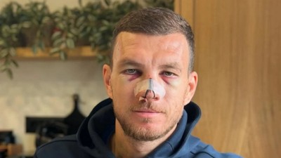 Fenerbahçe Osimhen'ini buldu: Dzeko maskeyle oynayacak