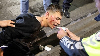 Alkollü sürücüden olaylı gece: Polis aracına tekme attı, “Dişim ağrıyor” diye feryat etti