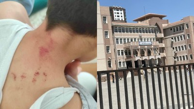 Şanlıurfa'da öğrencisini döven öğretmen tutuklandı