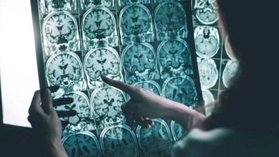 Bilim insanları stres altında çalışmaya 'son' dedi: Elektronik dövme dönemi