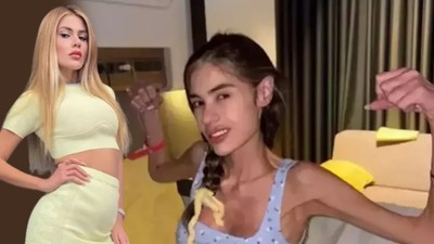 29 kiloya inen Nihal Candan'ın durumu ciddiyetini koruyor: Tekrar yoğun bakıma alındı