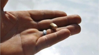 Bahçede otururken yorgun mermiyle hayatını kaybetti