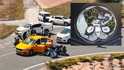 Kayseri'de uyuşturucu operasyonu: Midelerinden kapsül uyuşturucu çıktı