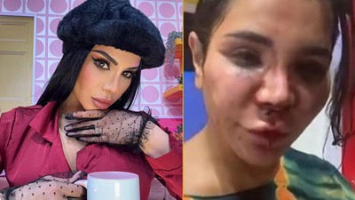 Fenomen isim hayatının şokunu yaşadı: Cinsel saldırı, şiddet! Çamaşır suyu döktüler...