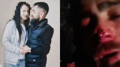 Yasak aşk yaşayıp ayrıldığı adama cehennemi yaşattı! Kulağını ve burnunu kopardılar