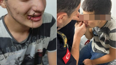 Ağzına balık oltası takılan çocuk, itfaiye ekiplerince kurtarıldı